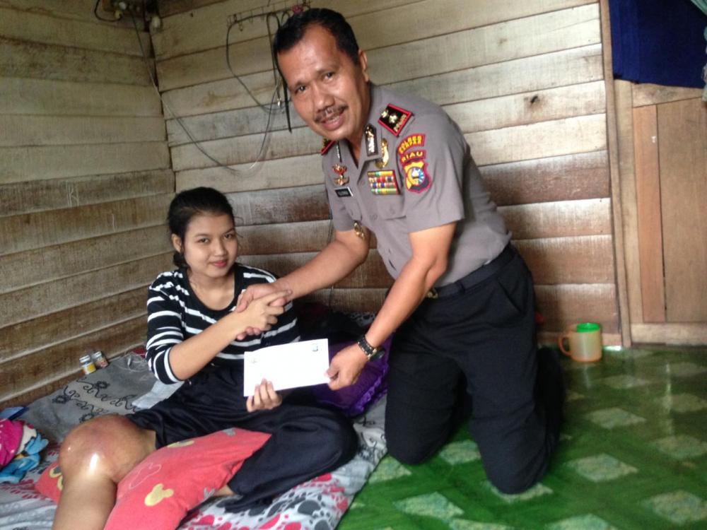 Riska Ramadila Gadis Berbakat Penderita Tumor Dikakinya di Kunjungi dan Beri Bantuan Oleh Kapolsek Kampar Kiri 