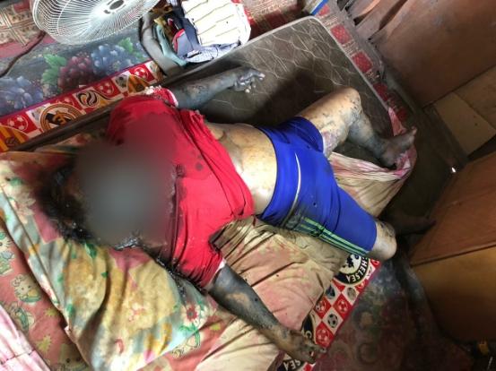 Miriss!! Penemuan Mayat Dalam Kamar Sudah Membusuk Ternyata Tukang Becak Ditembilahan