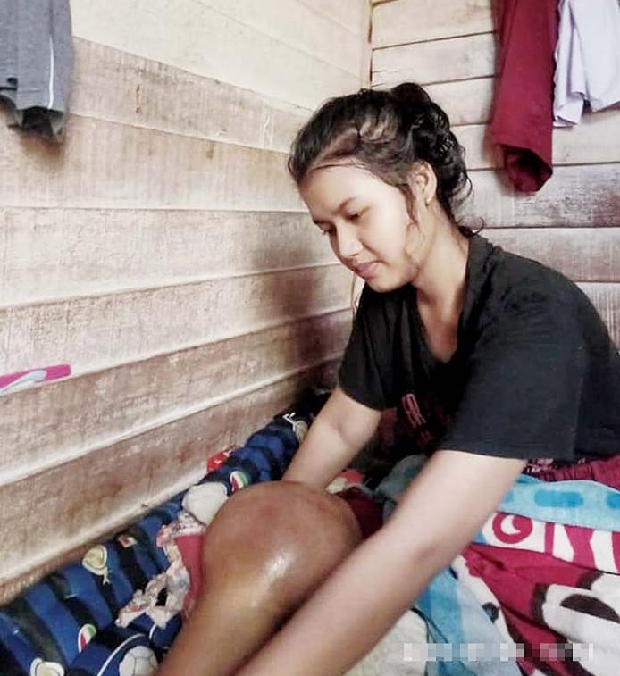 Ketiadaan Biaya Berobat Membuat Siswi Berbakat di Bidang Olahraga ini Hanya Bisa Terbaring Lemah.