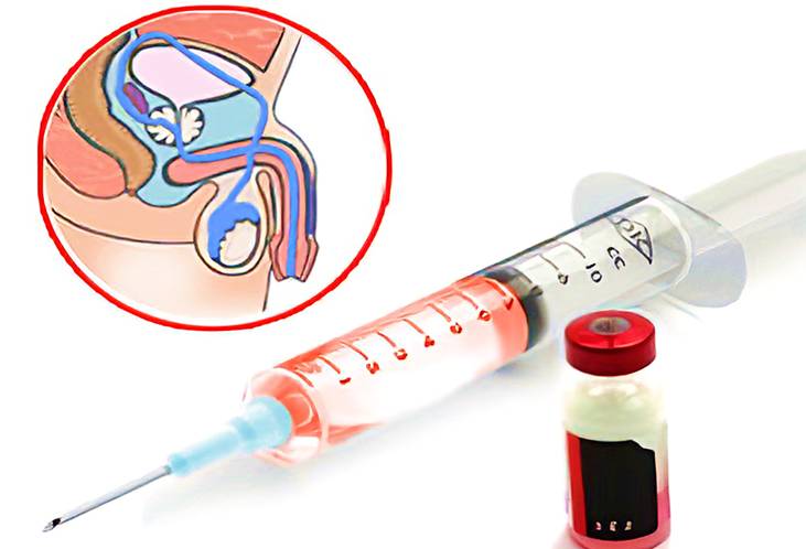 Setelah Kebiri Kimia, Para Pelaku Kekerasan Seksual Terhadap Anak Mendapatkan Rehabilitasi