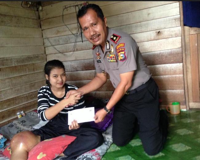 Gadis Berbakat Riska Ramadila.{17) Penderita Tumor Ganas Dilutut Akan Berobat Ke RSPAD Gatot Subroto Jakarta 