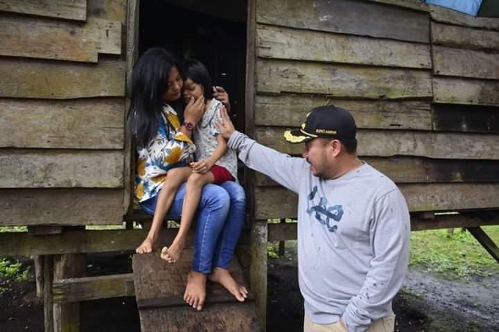 Kasiani(8) Penderita Tumor Dikepala Dikunjungi Bupati Kampar