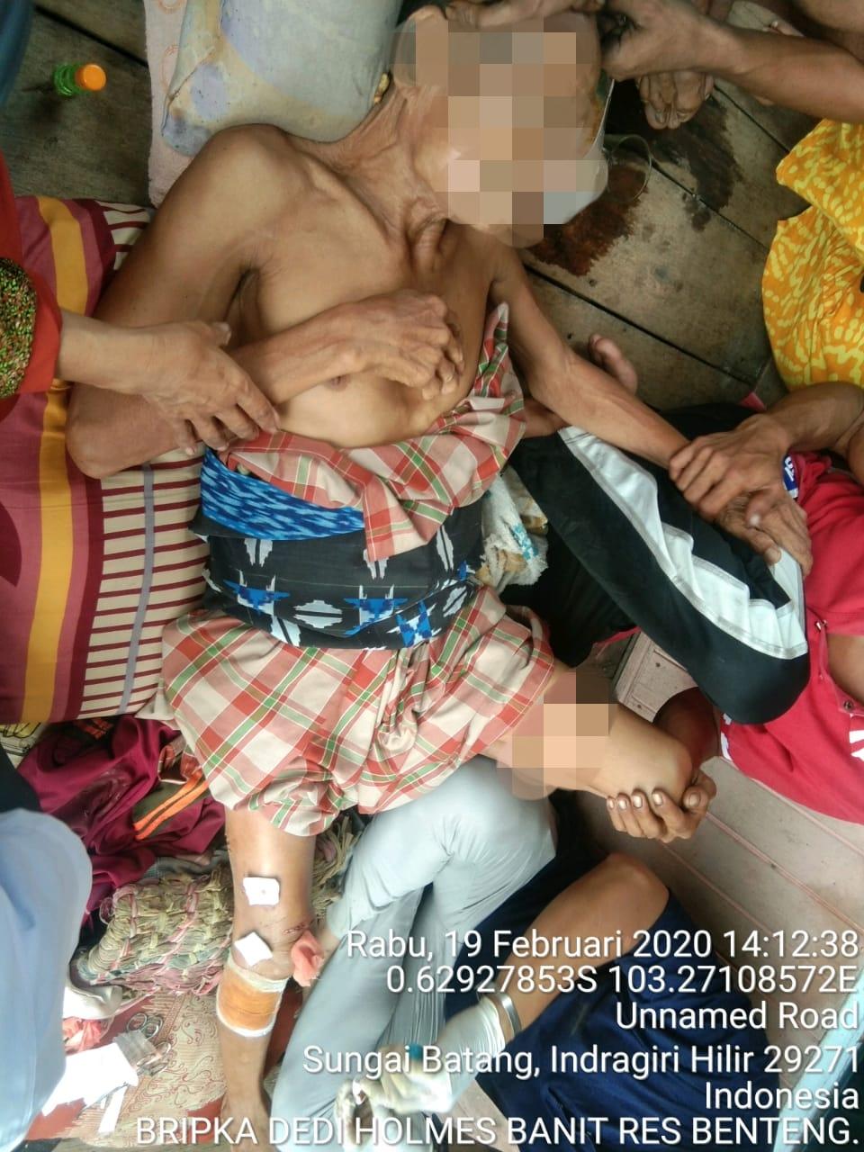 Kakek 70 Tahun Diserang Buaya Saat Mandi Mendapat 99 Jahitan