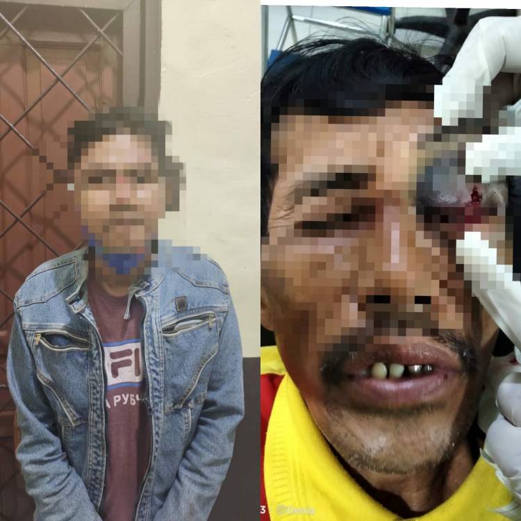 Tukang Ojek Dianiaya Oleh Penumpang Sendiri Lantaran Tak Punya Uang