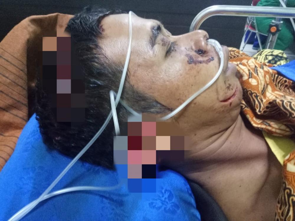 Selamat Dari Terkaman Harimau Warga Desa Pungkat, Gaung Alami Luka Parah