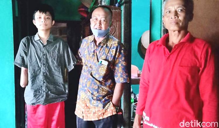 Tragedi Alfian, Siswa SMK yang Kehilangan 2 Tangan Saat PKL: Tetap Semangat dan Ingin Bisa Kuliah