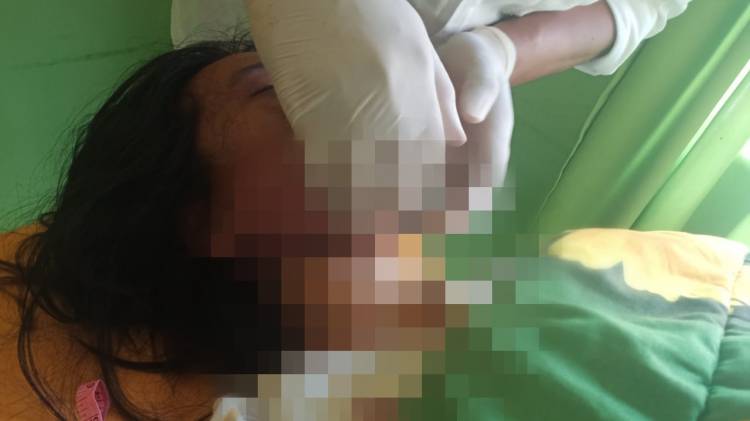 Ditolak Suami ML, Istri di Rohil Gantung Diri