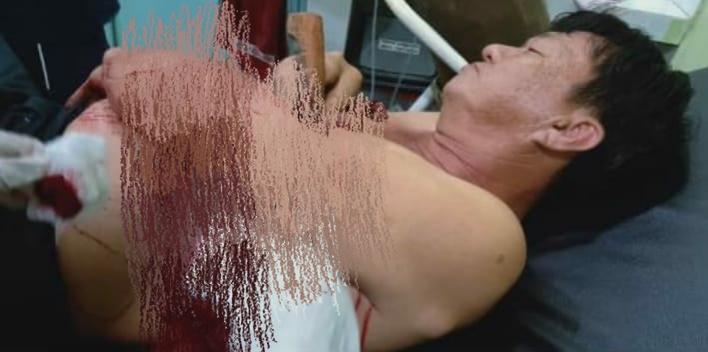 Atek Warga Keturunan Tionghoa di Pulau Burung Ditikam Orang Tak Dikenal, Badik Tertacap di Lengan