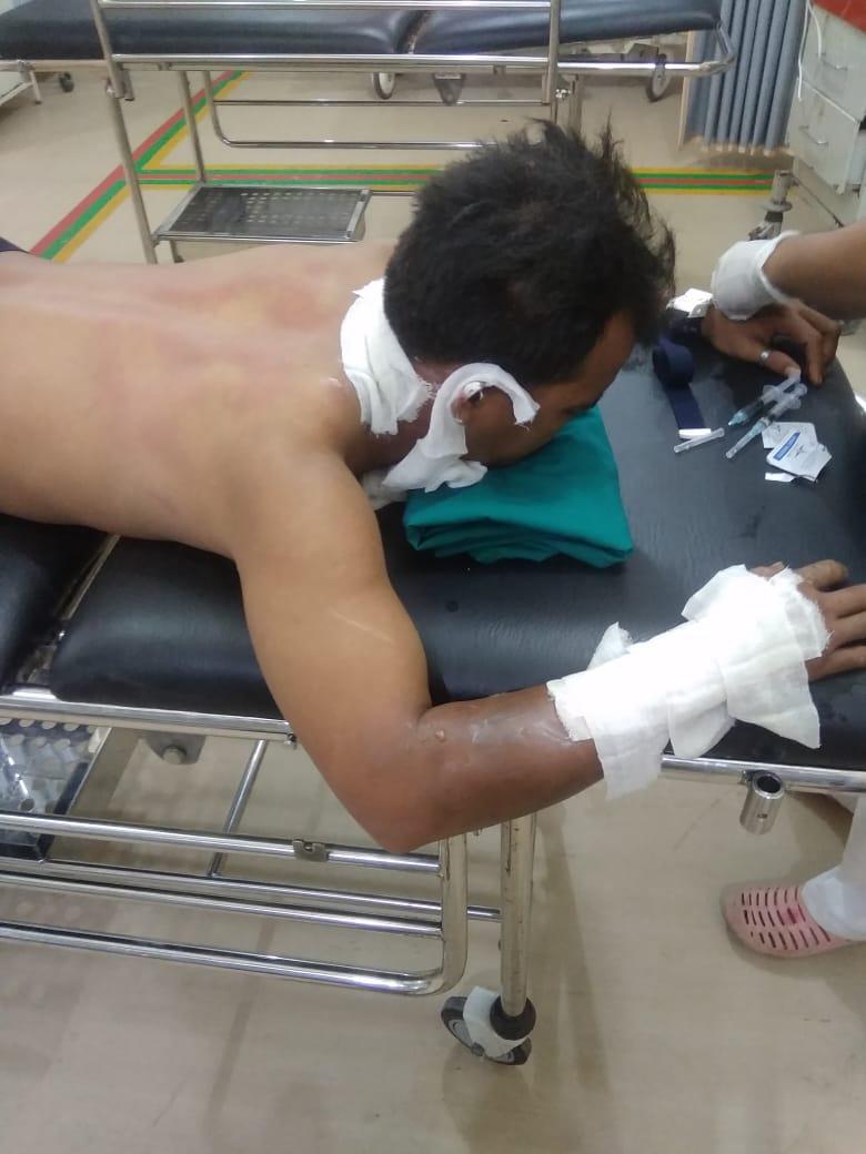Warga Pangkalan Kerinci Disiram Bensin dan Dibakar, Pelaku Langsung Kabur