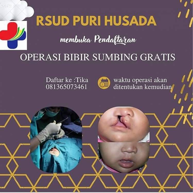 Segera Daftar, RSUD Puri Husada Tembilahan Akan Gelar Operasi Bibir Sumbing Gratis