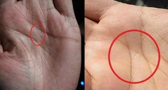 Inilah Garis Tangan Tanda-tanda Calon Orang Kaya Raya, Lihat Milikmu