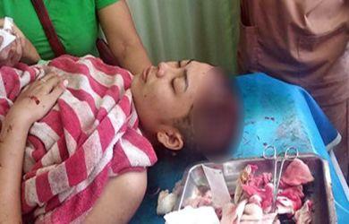 Jatuh Saat Intip Cewek Mandi, Driver Ojol Malah Aniaya Korban Dengan Palu 