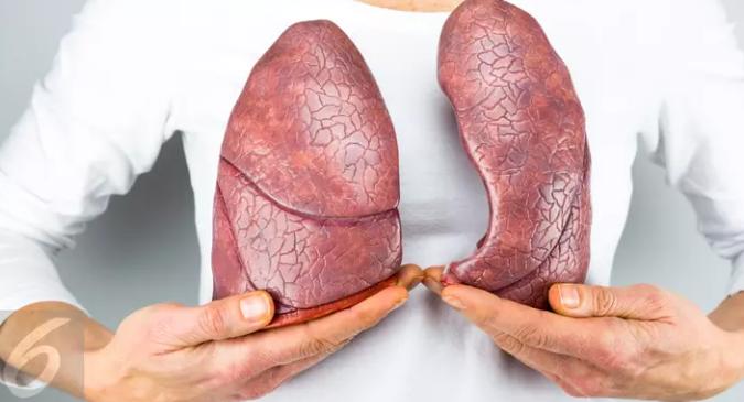 Waspadai Kanker Paru Ada di Tubuh Anda dengan 5 Ciri Ini