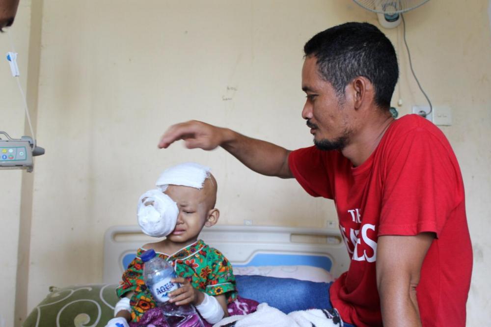 Putra Ramadhan, Bocah Penderita Kanker Mata Butuh Uluran Tangan