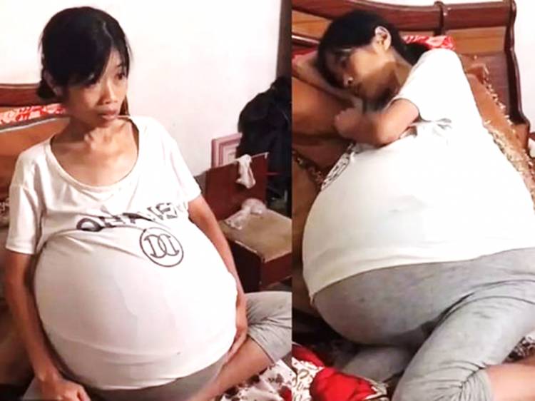 Masya Allah, Kemiskinan dan Penyakit Aneh Berpadu dalam Penderitaan Perempuan ini
