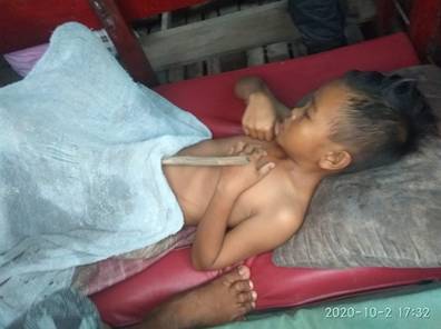 Mohon Bantuan Dermawan, Tubuh Bocah Keluarga Tak Mampu Desa Condong  Tertembus Bambu