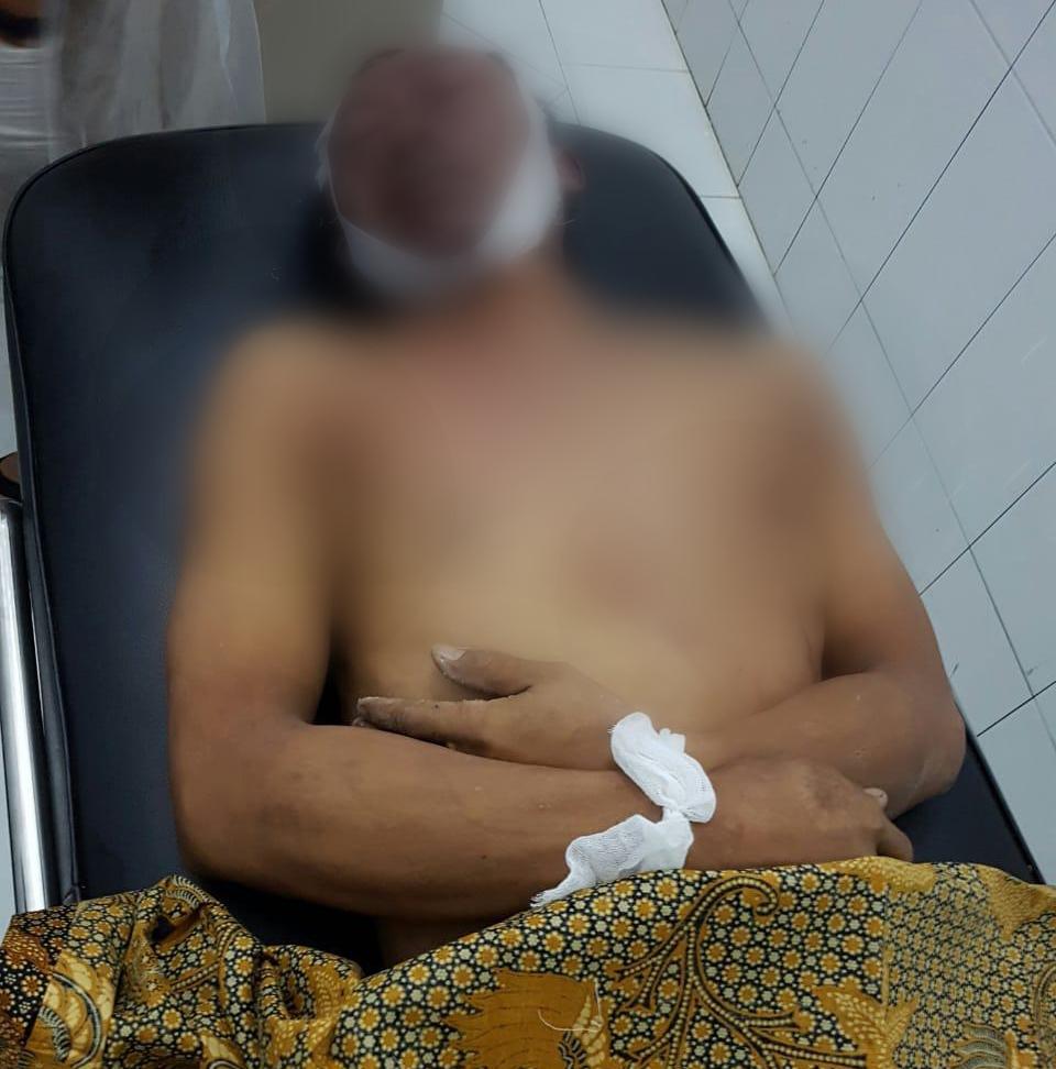 Candai Rekan Kerja, Warga Mojokerto Terjepit Saat Melompat dari Lift di Rohil