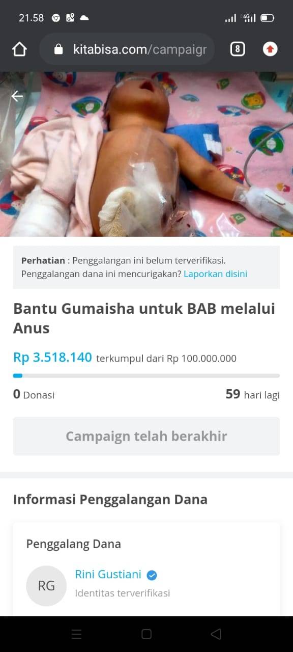 Minta Donasi Biaya Perawatan Rp100 Juta, Ini Klarifikasi Orang Tua Gumaisha
