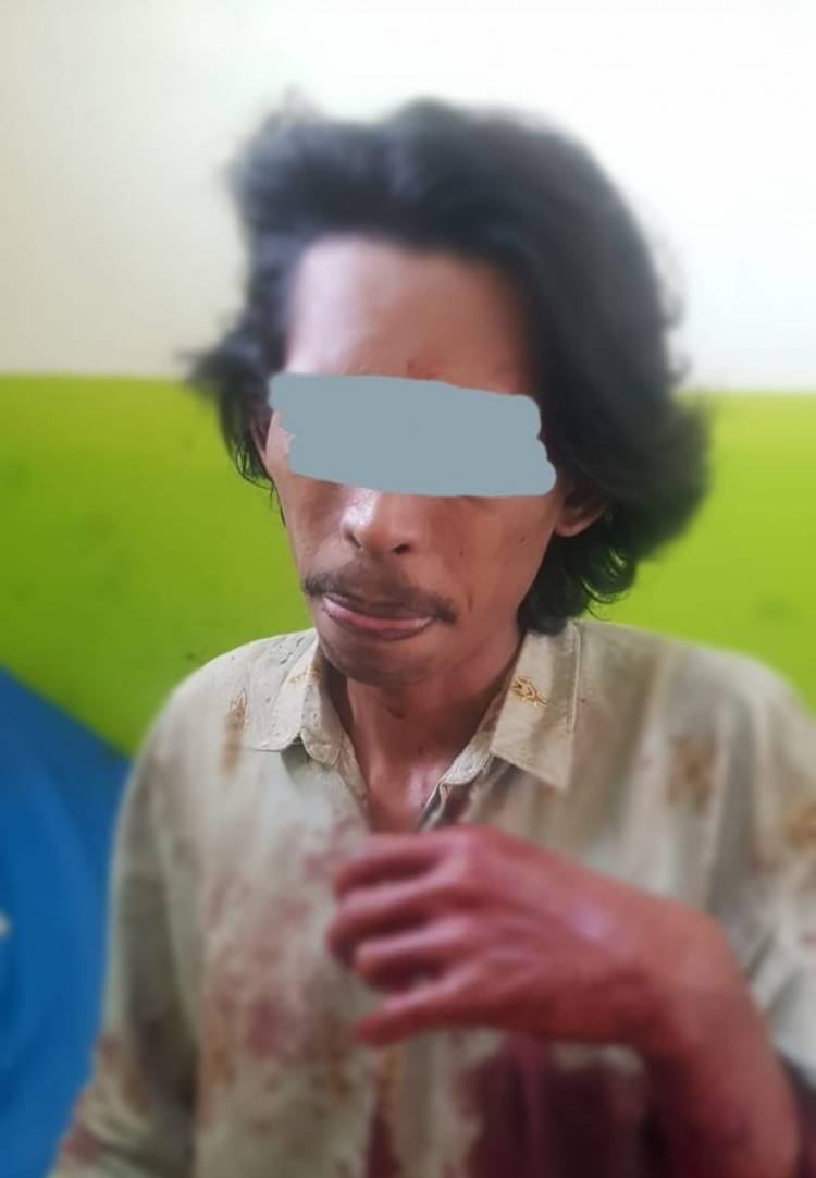 Cekcok Masalah Pohon Pinang, Dua Pria di Inhil Saling Bacok, Satu Nyawa Melayang