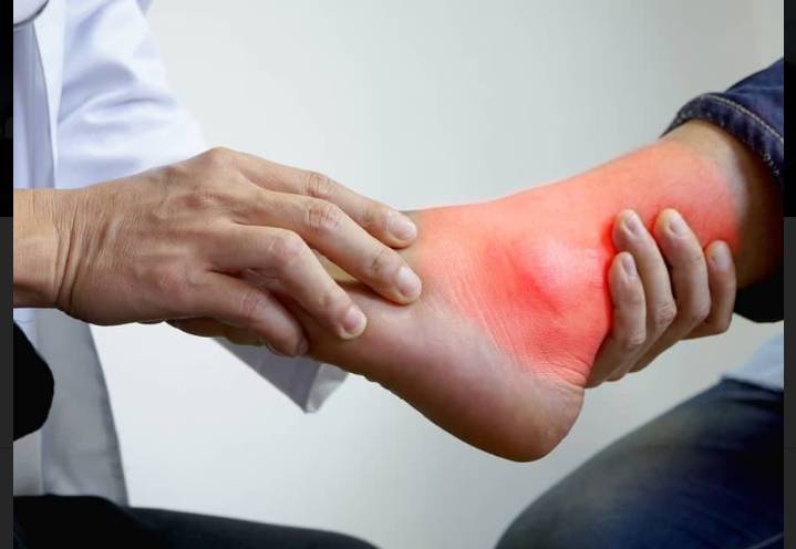 Cara Menurunkan Asam Urat, Ini tips nya