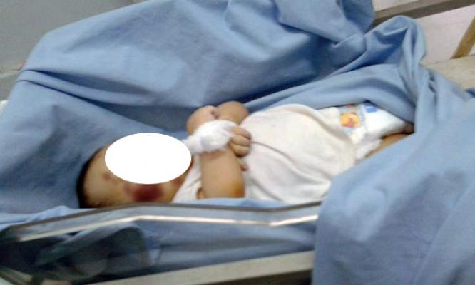 Balita Panti Asuhan Meninggal Tidak Wajar, DPRD Pekanbaru Nilai Dinas Sosial Kecolongan