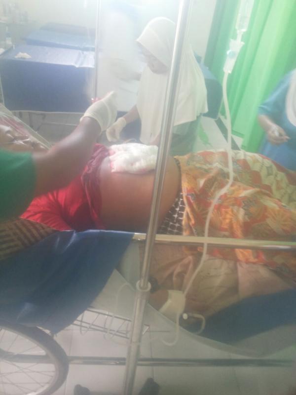Cekcok, Suami Nekat Tikam Istri