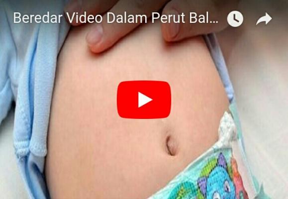 Beredar Video Dalam Perut Balita 4 Tahun Ditemukan Benda-benda Aneh saat Dioperasi di Surabaya