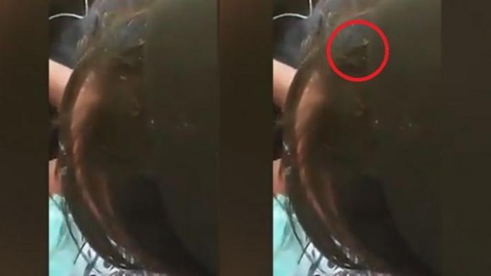 Geli nan Merinding, Video Ini Rekam Puluhan Kutu Rambut Bebas Berkeliaran di Kepala Pemiliknya