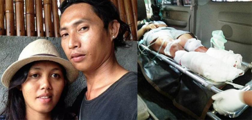 Potong Dua Kaki Istri Karena Cemburu Pria Ini Dituntut 9 Tahun Penjara