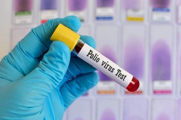 Vaksin Polio Provinsi Riau Tidak Capai Target