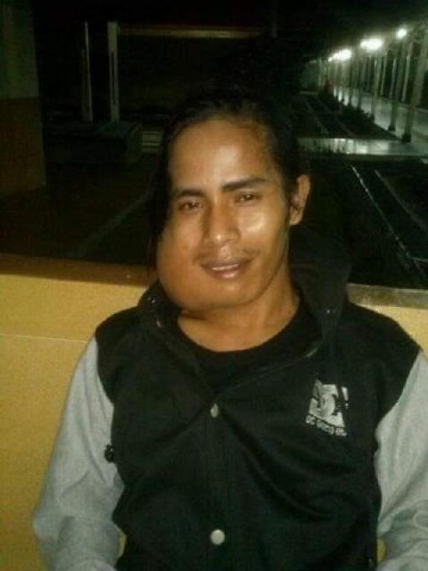 Sudah 10 Hari di RSUD Arifin Ahmad, Riko Warga Inhu yang Menderita Tumor Gusi Belum Dioperasi