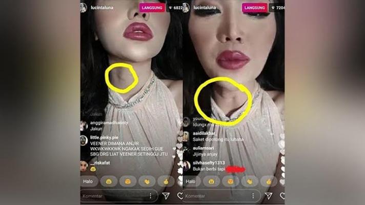 Bikin Heboh! Saat Live Instagram, Tenggorokan Lucinta Luna Jadi Sorotan, Sisa Jakun?