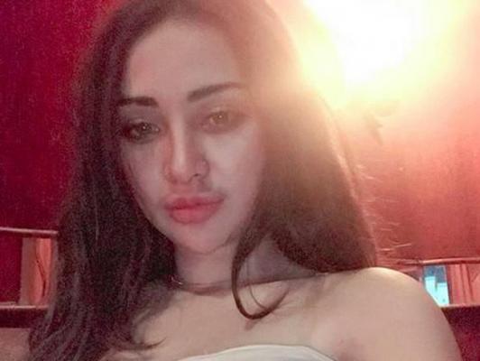 Cupi Cupita Serahkan Diri ke BNN, Netizen Ramai Menghujat
