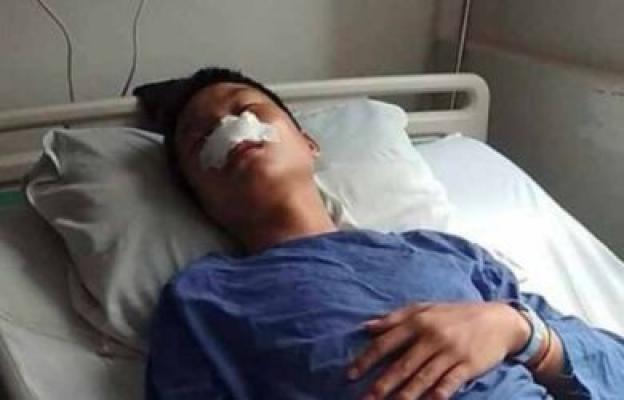 Pingsan Dipukuli Guru, Siswa SMA Harus Jalani Operasi