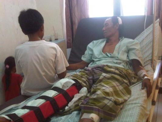 Ayah dari 2 Anak Ini Dikeroyok OTK Hingga Alami Patah Kaki