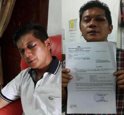 Abdul Gafar Korban Penganiayaan Berharap Polda Tahan Anggota DPRD Riau Yusuf Sikumbang