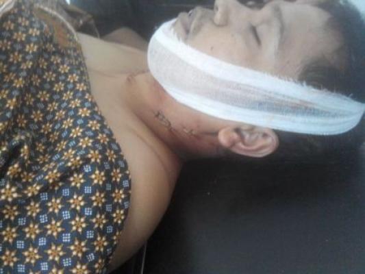 Leher Ditebas, Seorang Honorer Pemkab Kuansing Tewas Mengenaskan