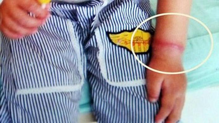 Bahaya Mengenakkan Gelang di Tangan Anak