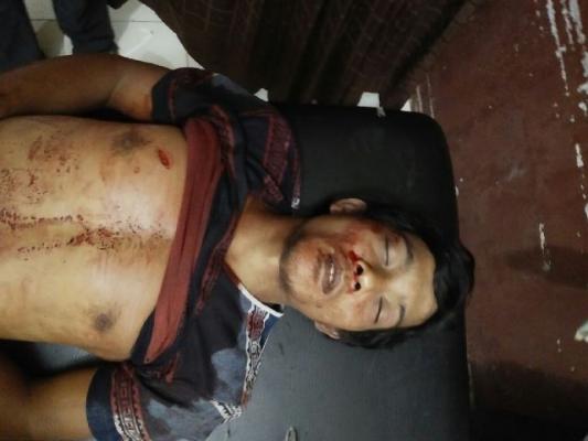 Seorang Pemuda Tewas Ditikam Saat Nonton Musik Orgen di Inhu Riau