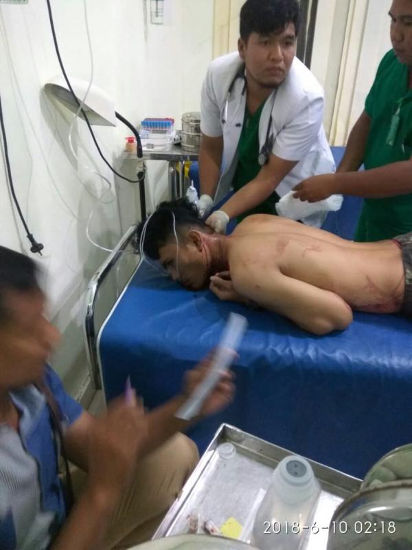Gara Gara di bilang,Burit ganal oleh segerombolan pemuda,sang pacar kena sabetan senjata tajam