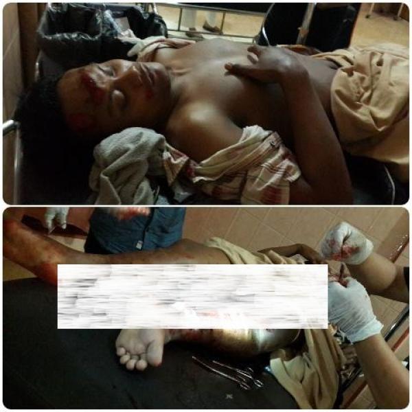 Dilindas Truk, Kaki Warga Bagan Batu Rohil Ini Remuk