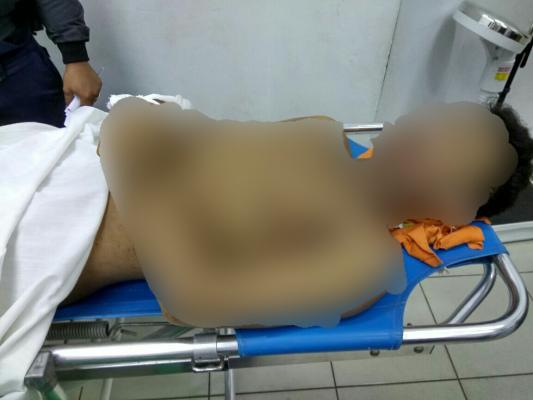 Seorang karyawan PT.PSG meninggal akibat kecelakaan kerja