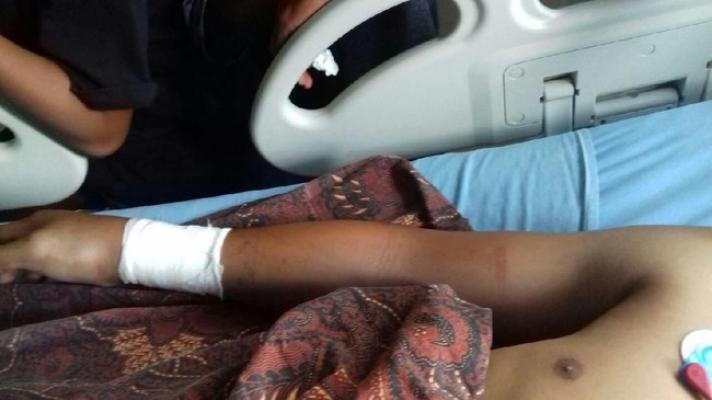 Keluarga Yakin Rizky Mati Suri Dipatuk King Cobra, Ini Respons RS