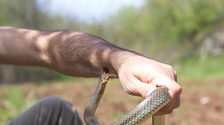 Rizki Tewas Dipatuk Ular King Cobra, Ini Cara Paling Tepat Tangani Gigitan Ular, Bukan Diikat ya