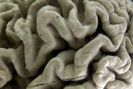 Penyebab Insomnia Pada Lansia Jumlah Syaraf Berkurang