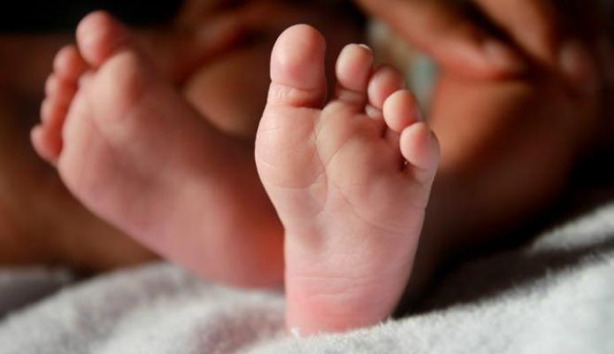 Rania, Bayi Pasien Pembengkakan Hati Asal Inhil Akhirnya Meninggal Dunia di RSCM Jakarta