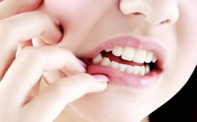 Ini Obat Alami Untuk Sembuhkan Nyeri Akibat Gigi Berlubang 