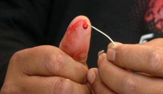Mengeluarkan Darah dari jari orang yg terkena STROKE