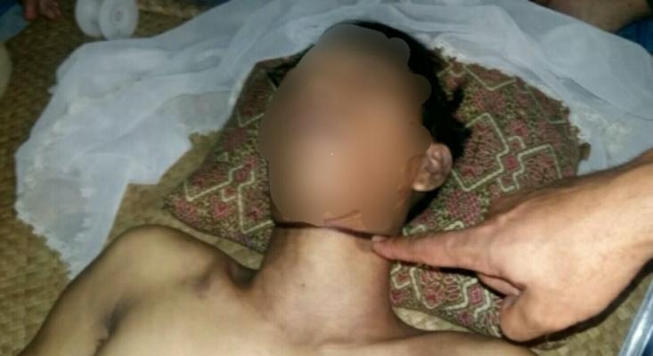 Seorang Pemuda di Pulau Kijang Ditemukan Tewas Tergantung di Pohon Mangga 