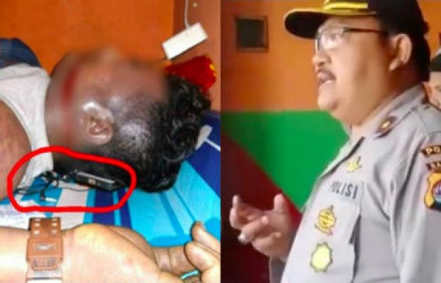 Tidur Pakai Headset, Telinga dan Hidung Keluarkan Darah, Innalillahi